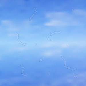 Image of blue sky with clouds and several floaters in the field of vision.